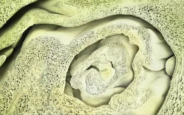thumbs 16 Еда под микроскопом от Карен Алперт